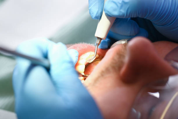 Best Broken Tooth Emergency  in Fairfield Bay, AR