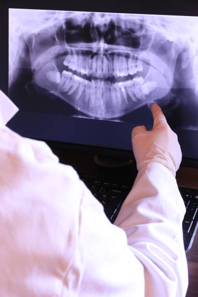 Best Chipped Tooth Repair Near Me  in Fairfield Bay, AR